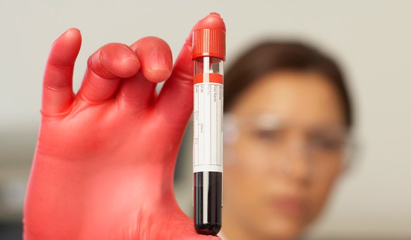 INFORME: Interpreta tus análisis de sangre
