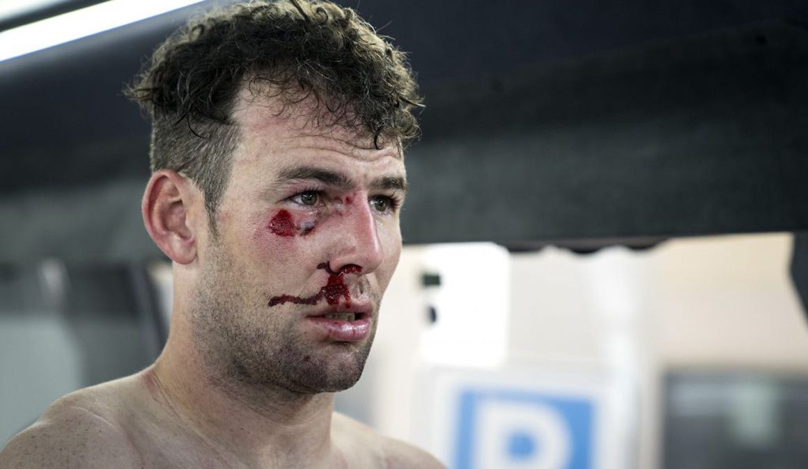 Cavendish sufre una fractura de costilla