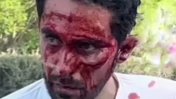 Imagen de Alberto Contador tras la caída en China