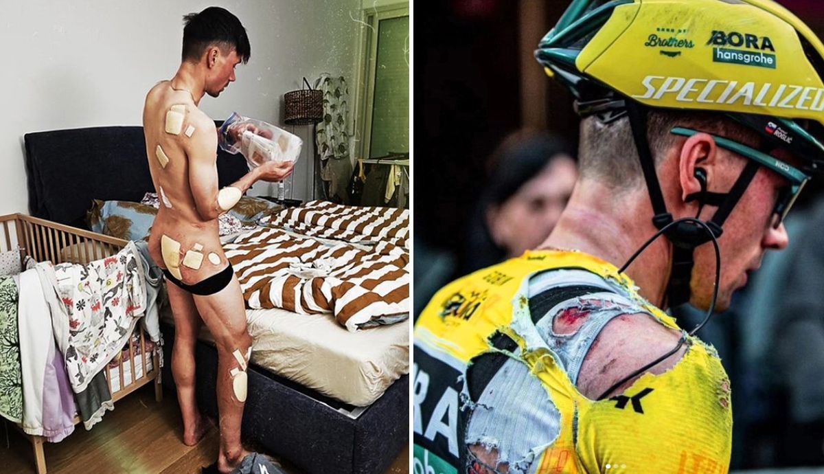 Primoz Roglic muestra las heridas tras sus caídas en la Itzulia